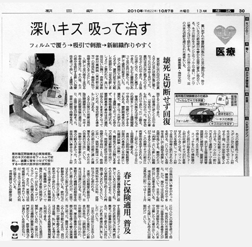 朝日新聞　局所陰圧閉鎖療法の記事