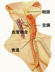 頚部食道がん切除後の再建